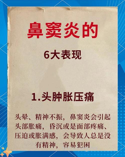 鼻窦炎不能轻视 鼻窦炎的6大症状