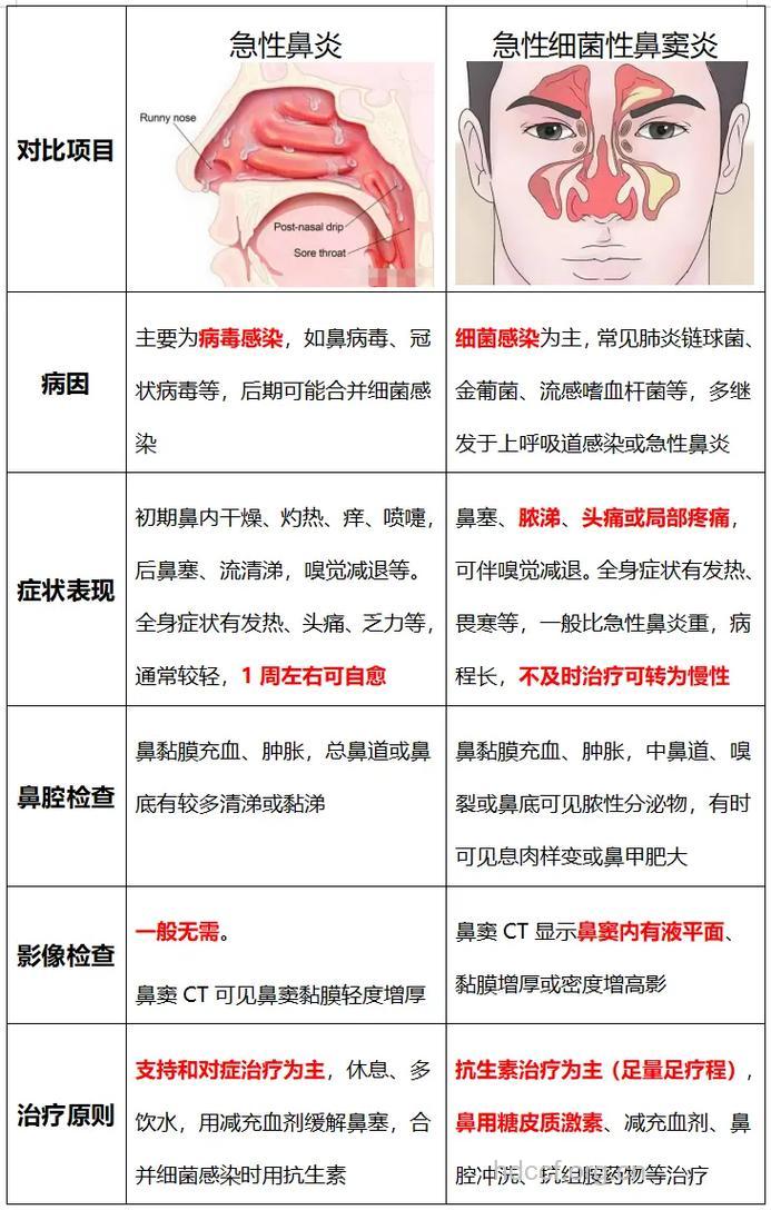 鼻炎和鼻窦炎有什么区别