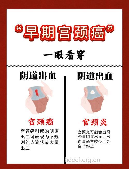 女性容易忽略的肿瘤信号