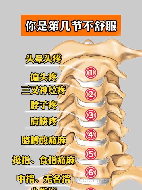 颈椎间盘突出的症状有哪些
