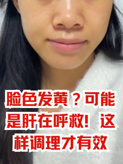 脸黄一定为肝炎吗?