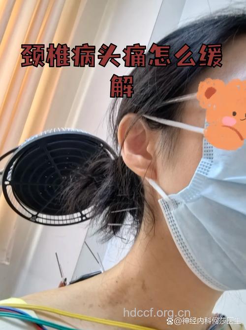 颈椎疾病可引起头痛