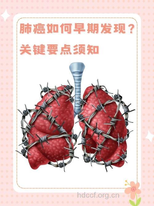 如何发现早期肺癌