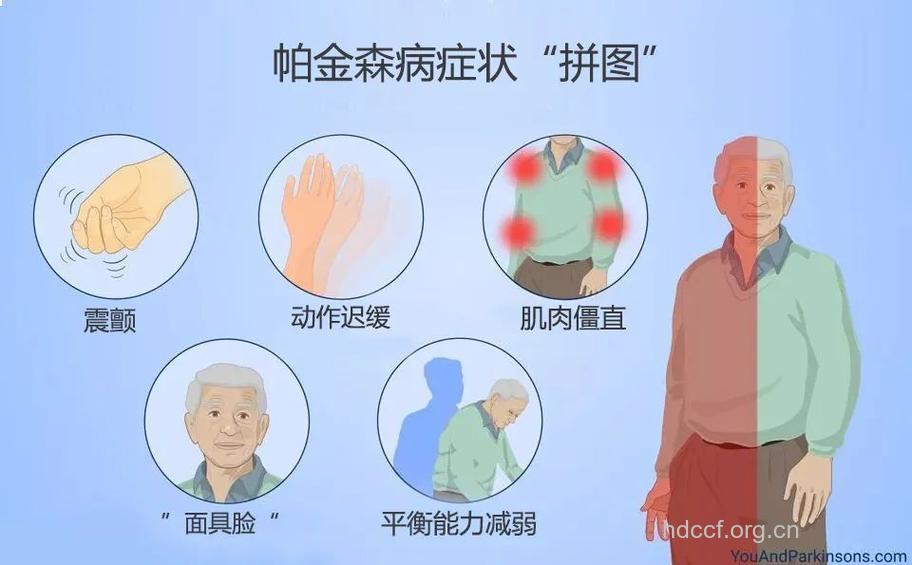 帕金森病可导致颈椎病