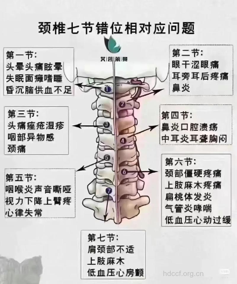 颈椎病的症状会有哪些呢