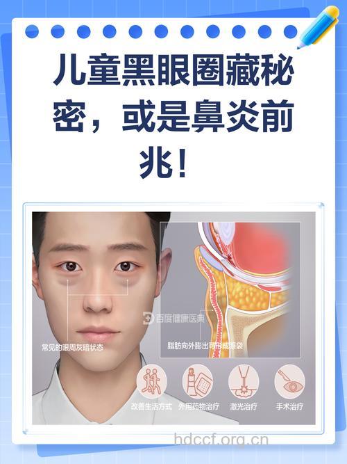 孩子常挂着黑眼圈可能是鼻炎引发的