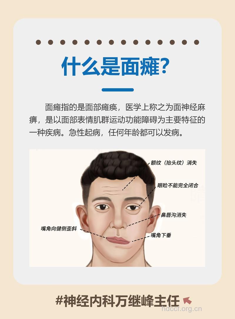 7种脸部面瘫有可能是肿瘤引起