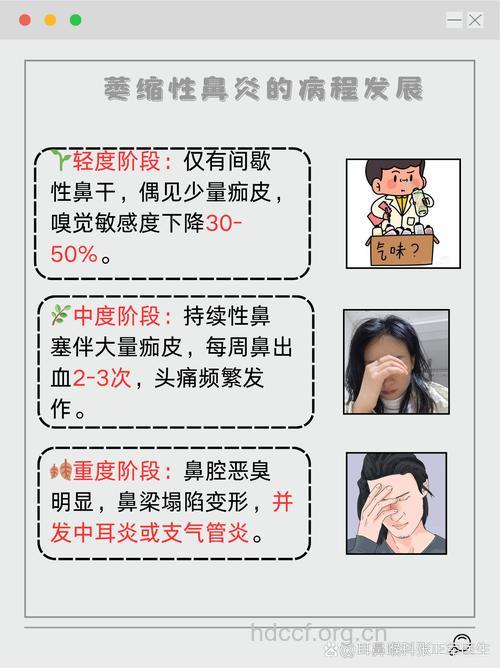 萎缩性鼻炎的症状有哪些呢