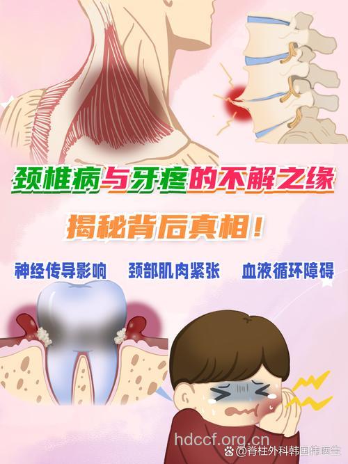 牙痛久治不愈与颈椎病有关吗