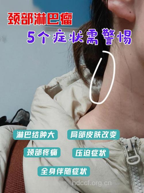 头颈癌有哪些典型症状