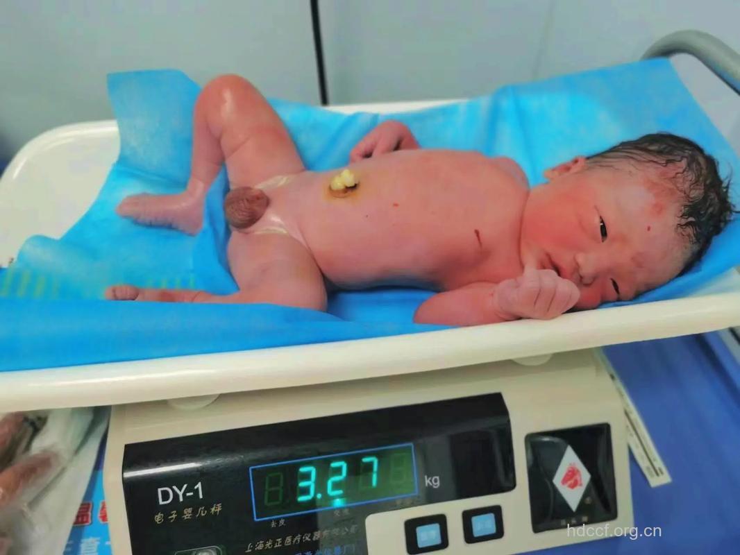 幼童肾脏长巨瘤重量达1.5公斤