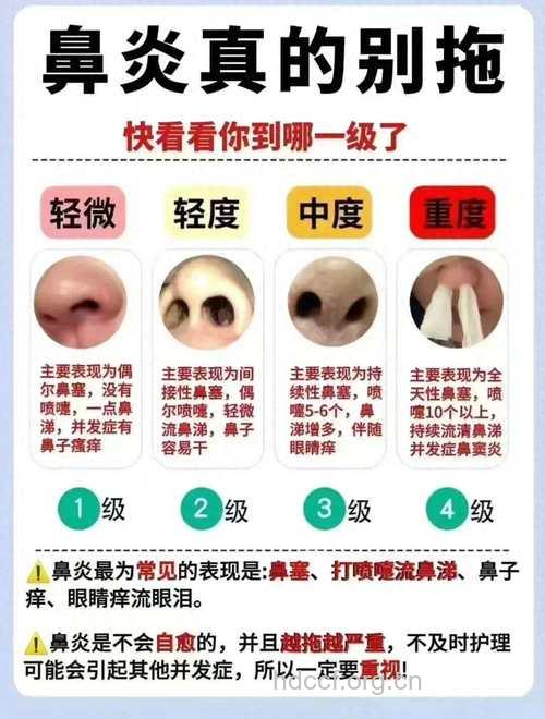 慢性鼻炎症状有哪些呢