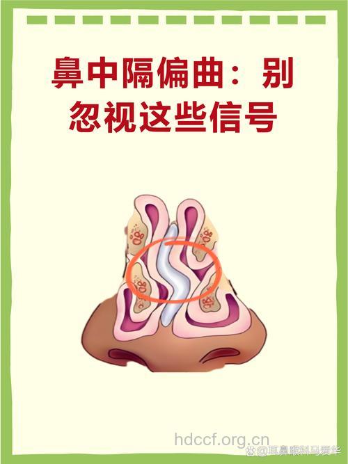 警惕：鼻中隔偏曲会加重鼻炎