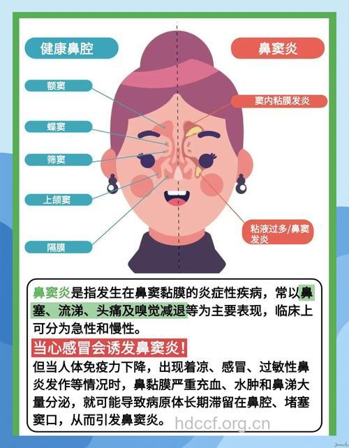 警惕：鼻子不通气可能是鼻窦炎