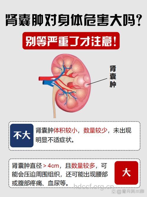 4大因素容易导致肾囊肿 什么情况才需做手术?