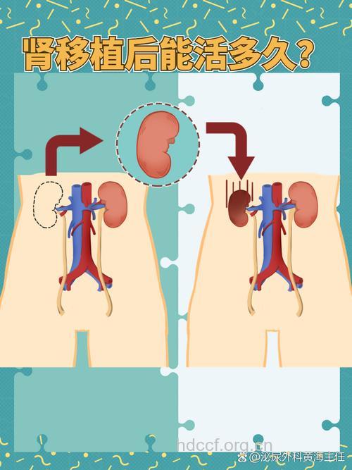 跨血型肾移植存活率更高