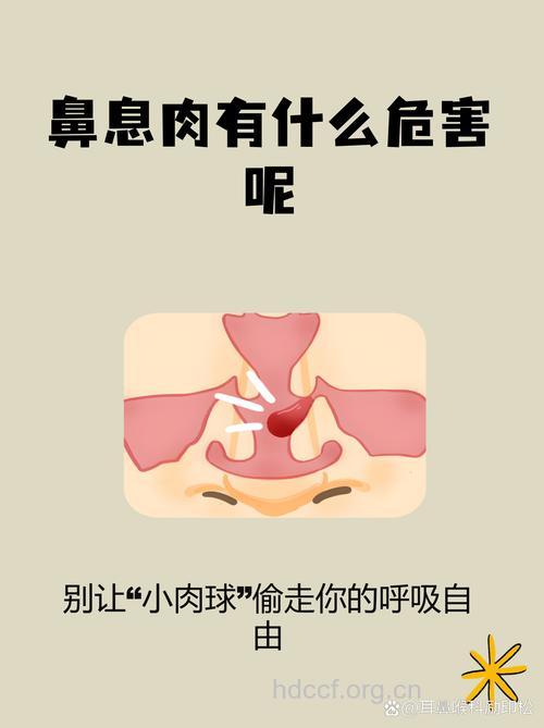 鼻息肉会产生什么危害呢