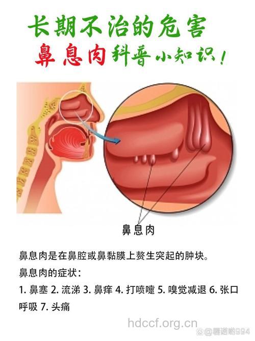鼻息肉危害的具体体现是什么