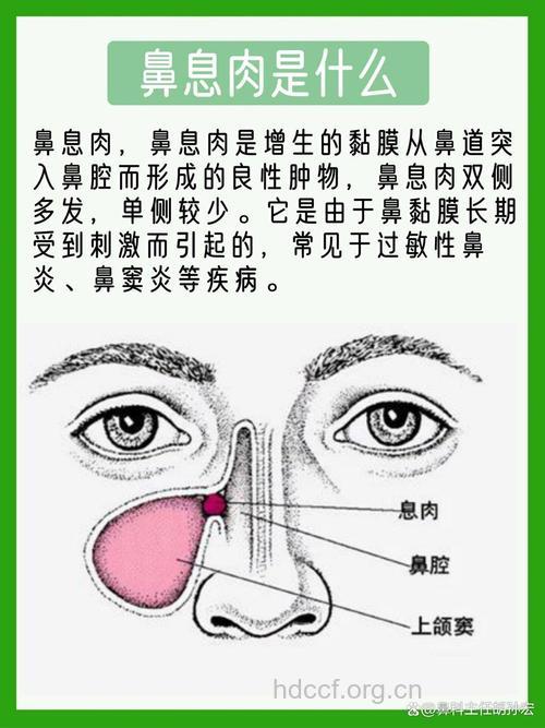 鼻息肉对身体有什么伤害