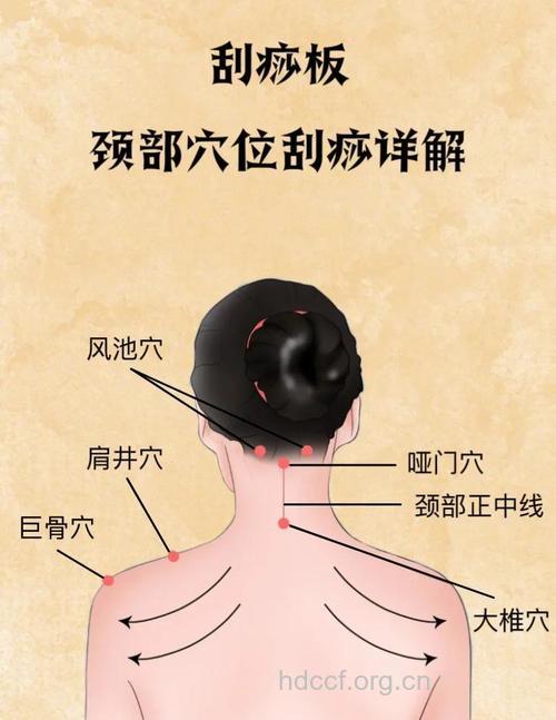 刮痧治疗颈椎病值得一试