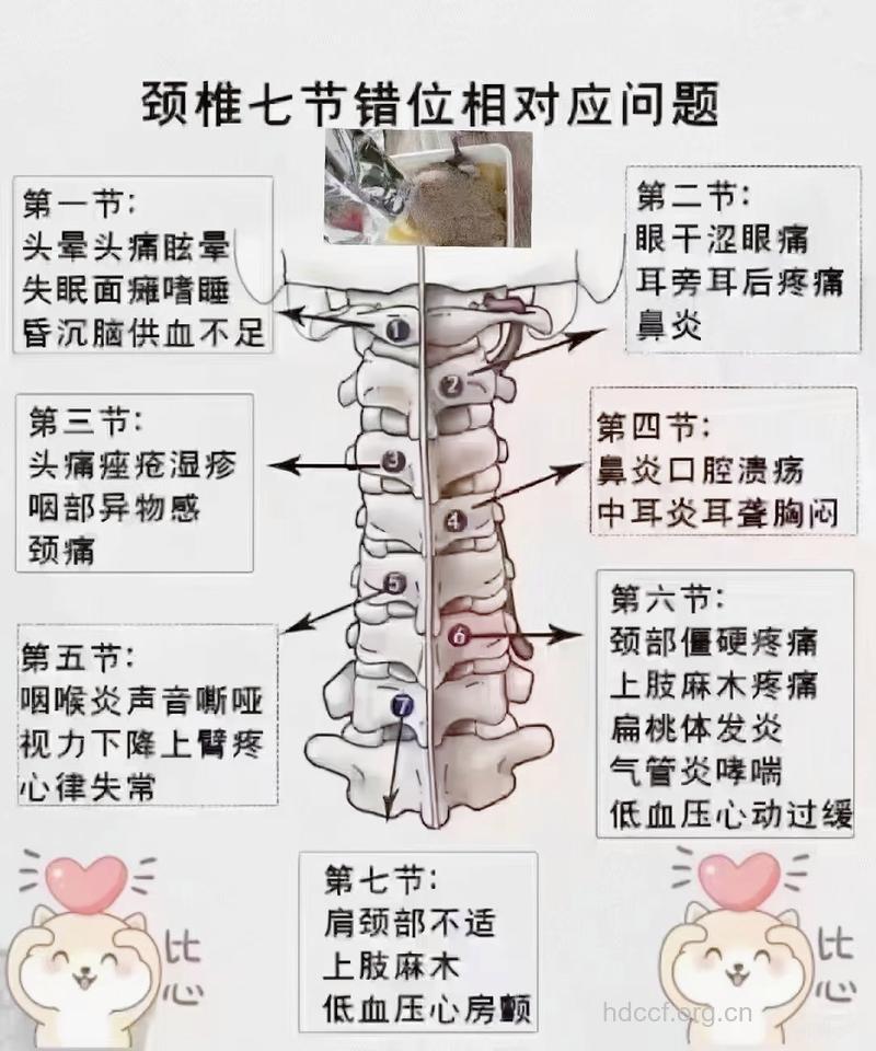 对颈椎疾病的基本认识及了解