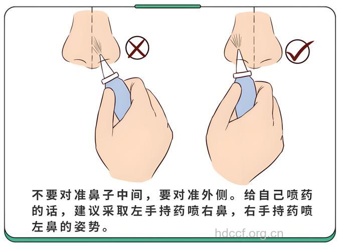 鼻炎如何正确滴用鼻药水