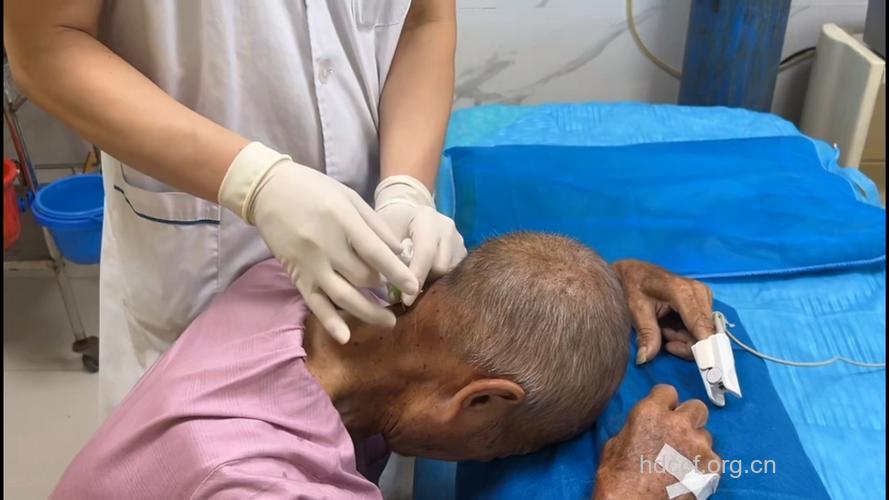 针孔手术,颈椎病可以不开刀