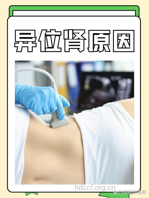 什么是异位肾？ 异位肾的病因及症状表现