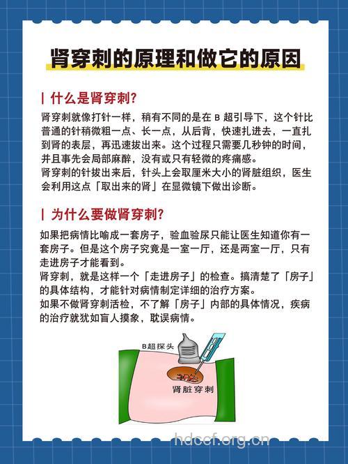 什么是肾穿刺 肾穿刺有何临床意义