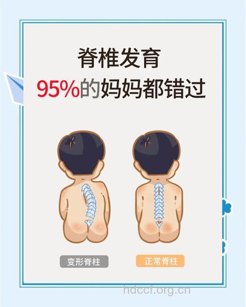 家长要留心小孩是否患有脊柱侧凸