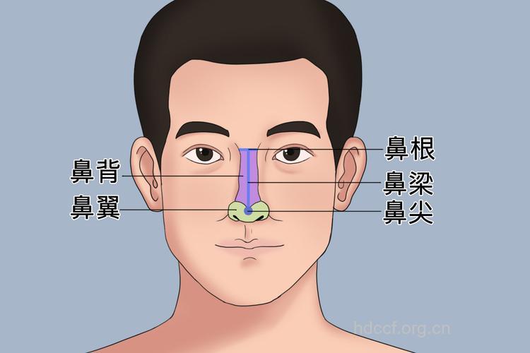 小心打篮球打出鼻中隔偏曲