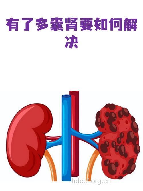 预防多囊肾的方法有哪些呢