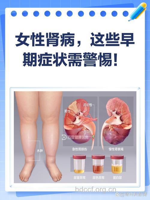 女性得肾病的症状有哪些