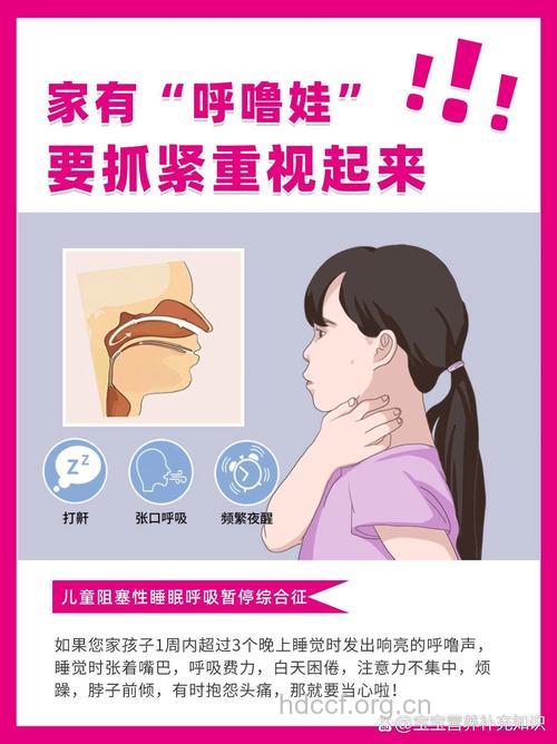 小儿鼾症的特征是什么