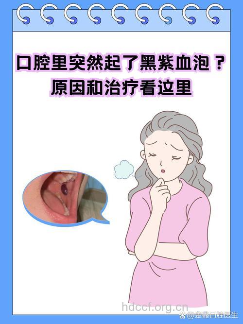 糖尿病肾病引发的口腔并发症