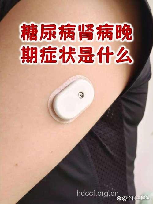 晚期糖尿病肾病的症状