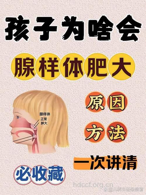 儿童腺样体肥大应及早治疗