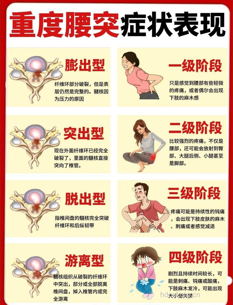 诱发腰椎间盘突出的因素是什么
