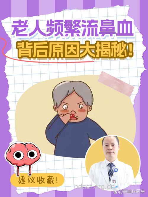 老人鼻出血,恐为高血压