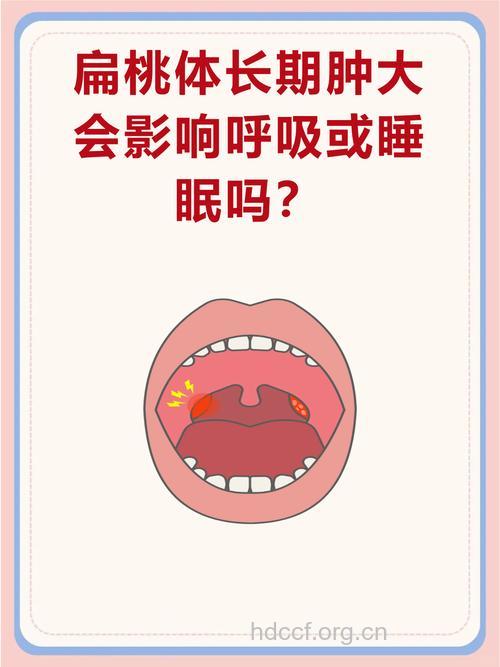 扁桃体炎可导致幼儿睡眠