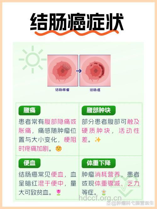常见的直肠癌早期症状
