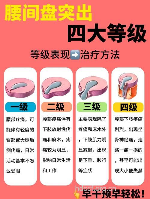 腰椎间盘突出的检查标准