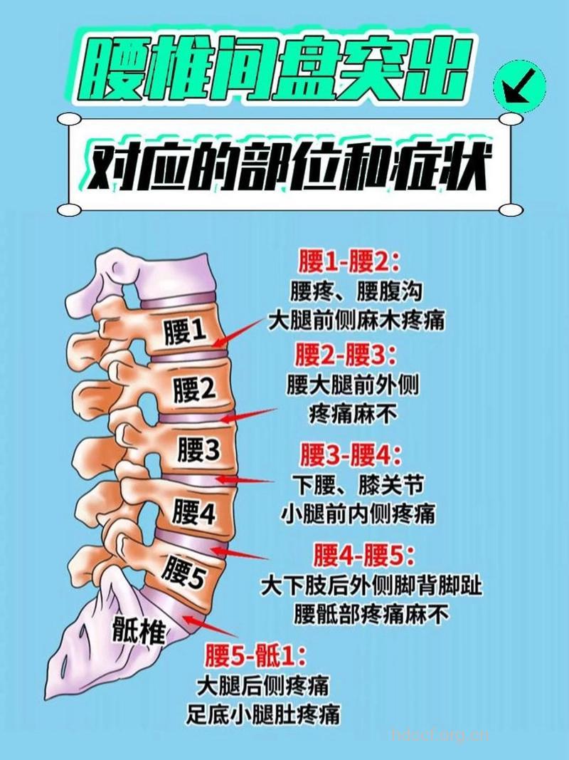 腰椎间盘突出症发作时有什么表现