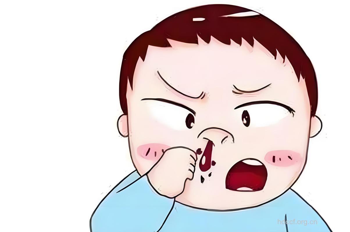 爱抠鼻子的孩子鼻子易出血