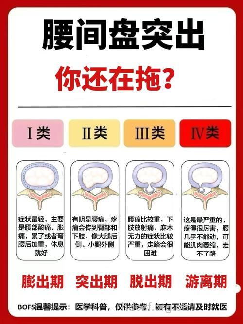 腰椎间盘突出的症状是如何表现的