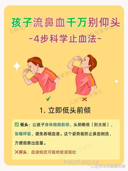 小孩流鼻血不能仰头