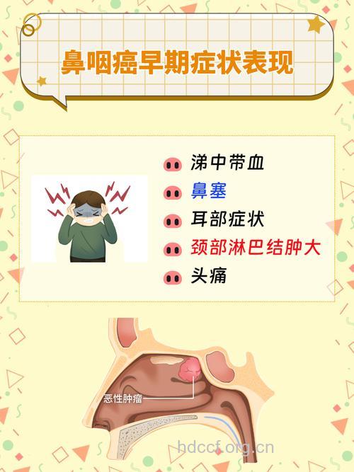 鼻咽癌早期信号的警示