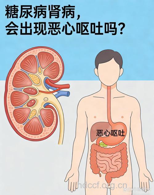 糖尿病肾病腹胀、呕吐
