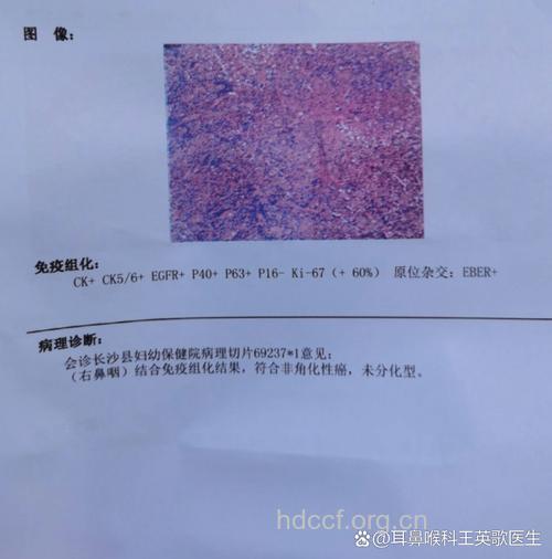 鼻瓣膜区病变诊断