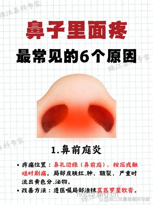 鼻中隔血肿的详细介绍